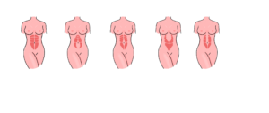 RD Typen
